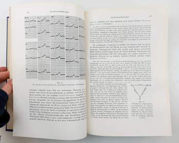 Max Holzmann: Klinische Elektrokardiographie