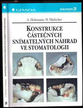 Konstrukce částečných snímatelných náhrad ve stomatologii