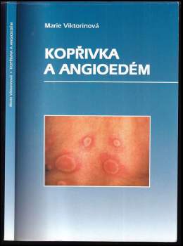 Kopřivka a angioedém