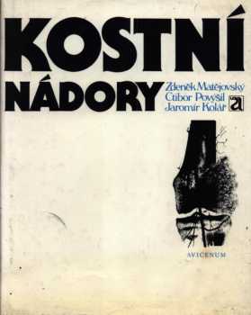 Kostní nádory