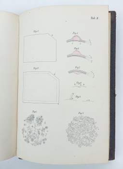 Alfred Vogel: Lehrbuch der Kinderkrankheiten