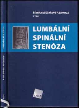 Lumbální spinální stenóza