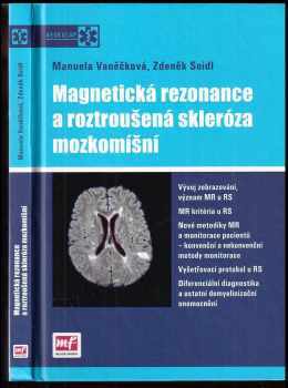 Manuela Vaněčková: Magnetická rezonance a roztroušená skleróza mozkomíšní