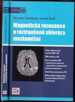 Magnetická rezonance a roztroušená skleróza mozkomíšní