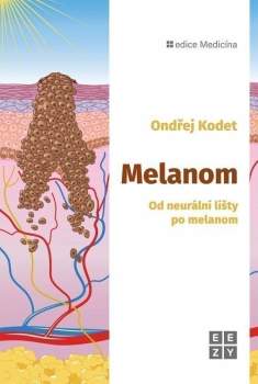 Melanom