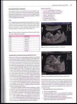 Aleš Roztočil: Moderní porodnictví