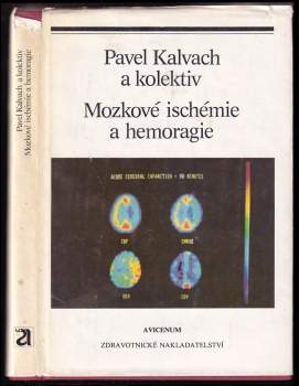 Mozkové ischémie a hemoragie