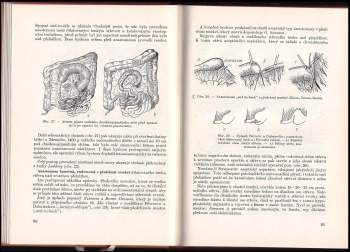Václav Tosovský: Náhlé příhody břišní na podkladě vrozených úchylek u dětí
