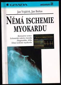 Němá ischemie myokardu