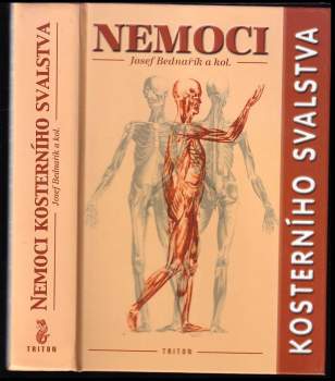 Nemoci kosterního svalstva
