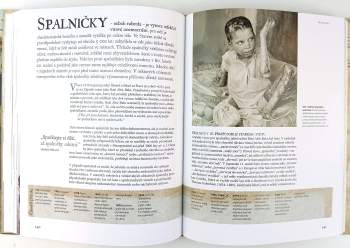 Mary J Dobson: Nemoci