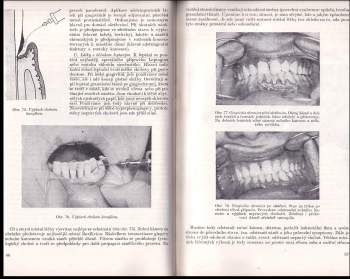 Miroslav Škach: Nemoci paradontu