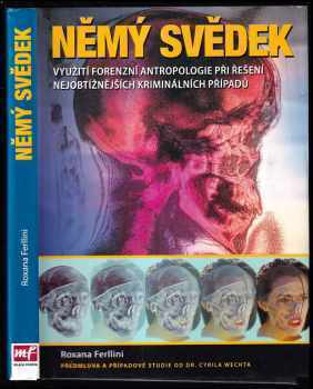 Němý svědek : [využití forenzní antropologie při řešení nejobtížnějších kriminálních případů]