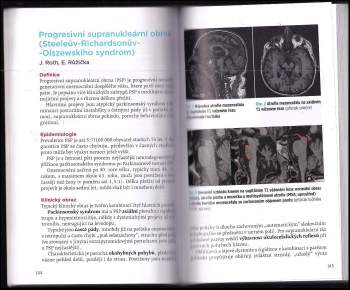 Robert Rusina: Neurodegenerativní onemocnění