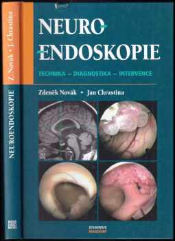 Neuroendoskopie