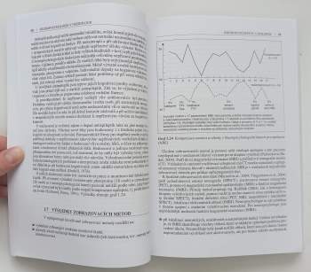 Marek Preiss: Neuropsychologie v neurologii