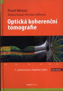 Optická koherenční tomografie