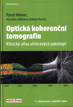 Optická koherenční tomografie