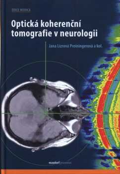 Optická koherenční tomografie v neurologii