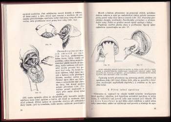 Heřman Sikl: Pathologicko-anatomická pitevní technika a základy diagnostiky