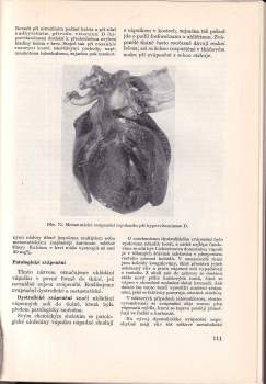 Patologická anatomie