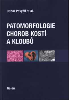 Patomorfologie chorob kostí a kloubů