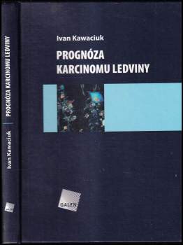 Ivan Kawaciuk: Prognóza karcinomu ledviny