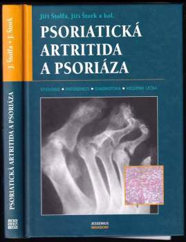 Psoriatická artritida a psoriáza