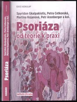 Psoriáza