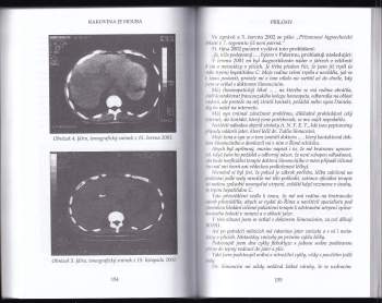 Tullio Simoncini: Rakovina je houba