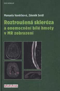Roztroušená skleróza a onemocnění bílé hmoty v MR zobrazení