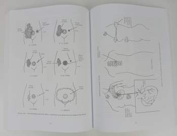 Barbara Ann Brennan: Ruce světla