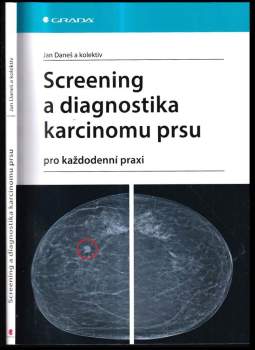Screening a diagnostika karcinomu prsu