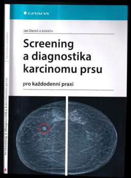 Screening a diagnostika karcinomu prsu : pro každodenní praxi