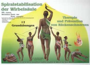 Spiralstabilisation der Wirbelsäule