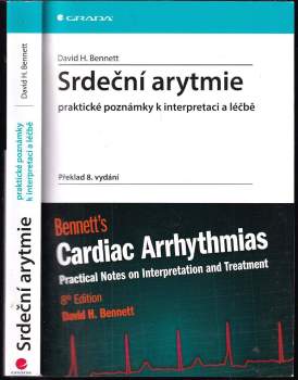 Srdeční arytmie