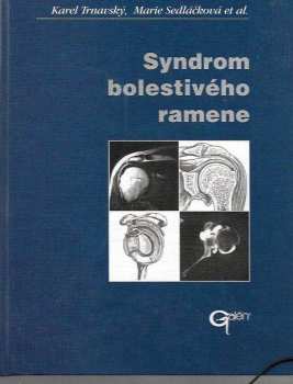 Syndrom bolestivého ramene