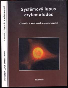 Systémový lupus erytematodes