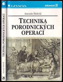 Technika porodnických operací