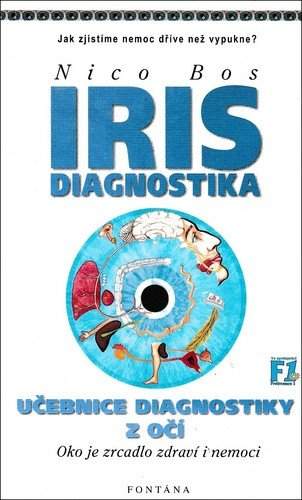 Irisdiagnostika