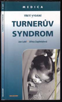 Turnerův syndrom