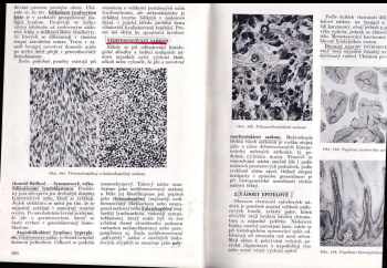 Blahoslav Bednář: Učebnice patologické anatomie