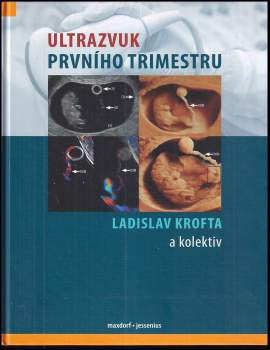 Ladislav Krofta: Ultrazvuk prvního trimestru
