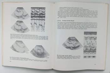 Evžen Čech: Ultrazvuk v lékařské diagnostice a terapii