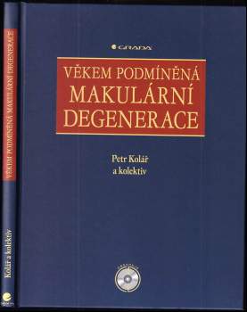Věkem podmíněná makulární degenerace