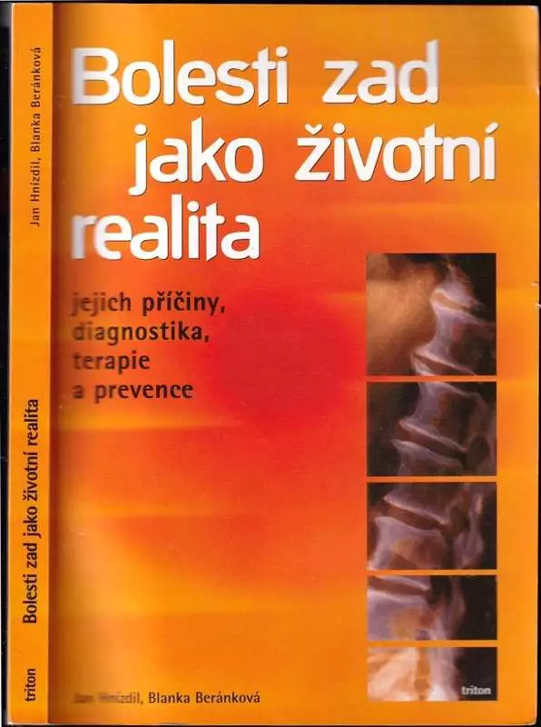 Bolesti zad jako životní realita : jejich příčiny, diagnostika, terapie a prevence