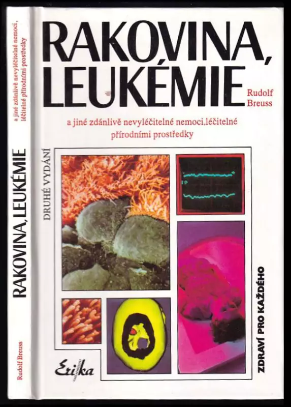 Rakovina, leukémie a jiné zdánlivě nevyléčitelné nemoci, které jsou léčitelné přírodními prostředky záznamy z tisíců zkušeností k blahu všeho lidstva 