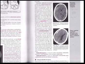 Zdeněk Ambler: Základy neurologie