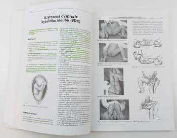 Antonín Sosna: Základy ortopedie