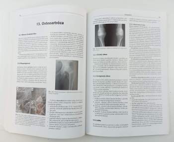 Antonín Sosna: Základy ortopedie